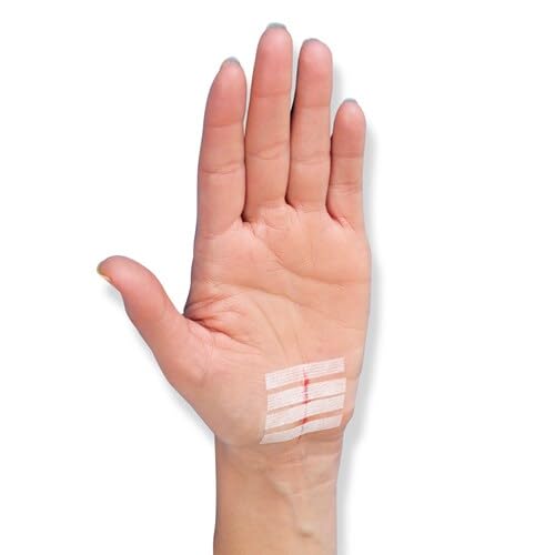 Nexcare Steri-Strip Wound Closure, 30 Count