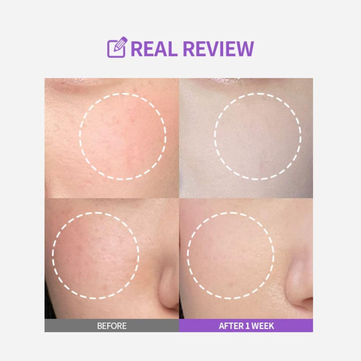 SUNGBOON EDITOR Meoru Podo Vita C Turn-over Ampoule, 1.01 fl oz