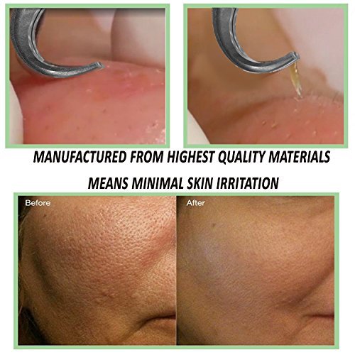 FEITA Blackhead Remover Kit, 5 Count