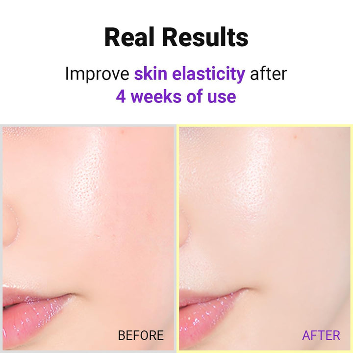 IsNtree Hyper Retinol EX 1.0 Serum, 20 ml