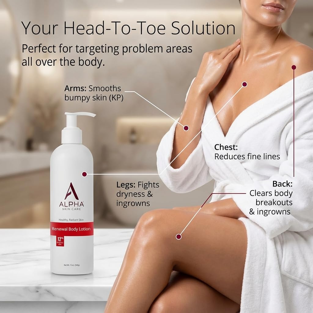 Alpha Skin Care Revitalizing Body Lotion, 12% Glycolic AHA, 12 oz