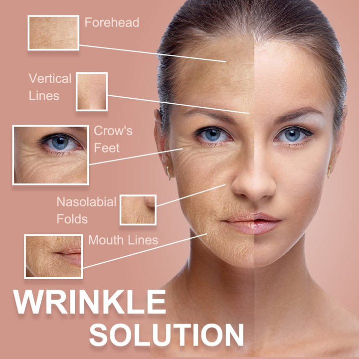 Akissos Anti Wrinkle Patches, 2 Count