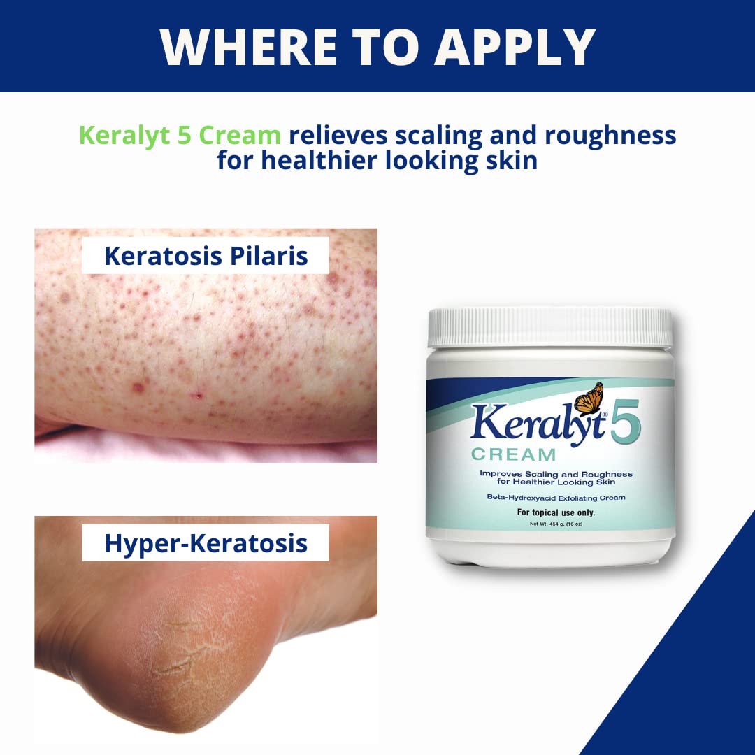Keralyt 5 Cream, 5%