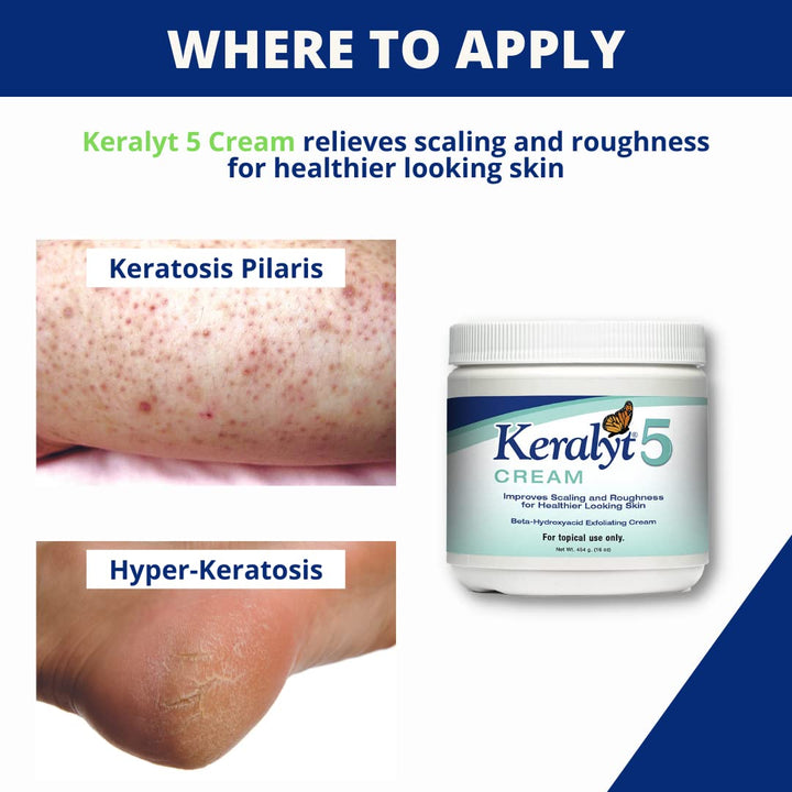Keralyt 5 Cream, 5%