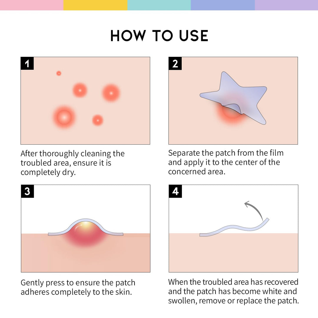 #OOTD Pastel Star Pimple Patches, 80 Count