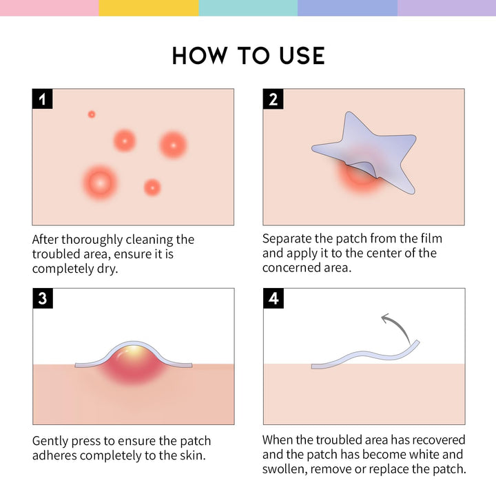 #OOTD Pastel Star Pimple Patches, 80 Count