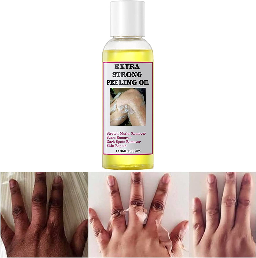 DUHANXI Peeling Oil, 1 Count