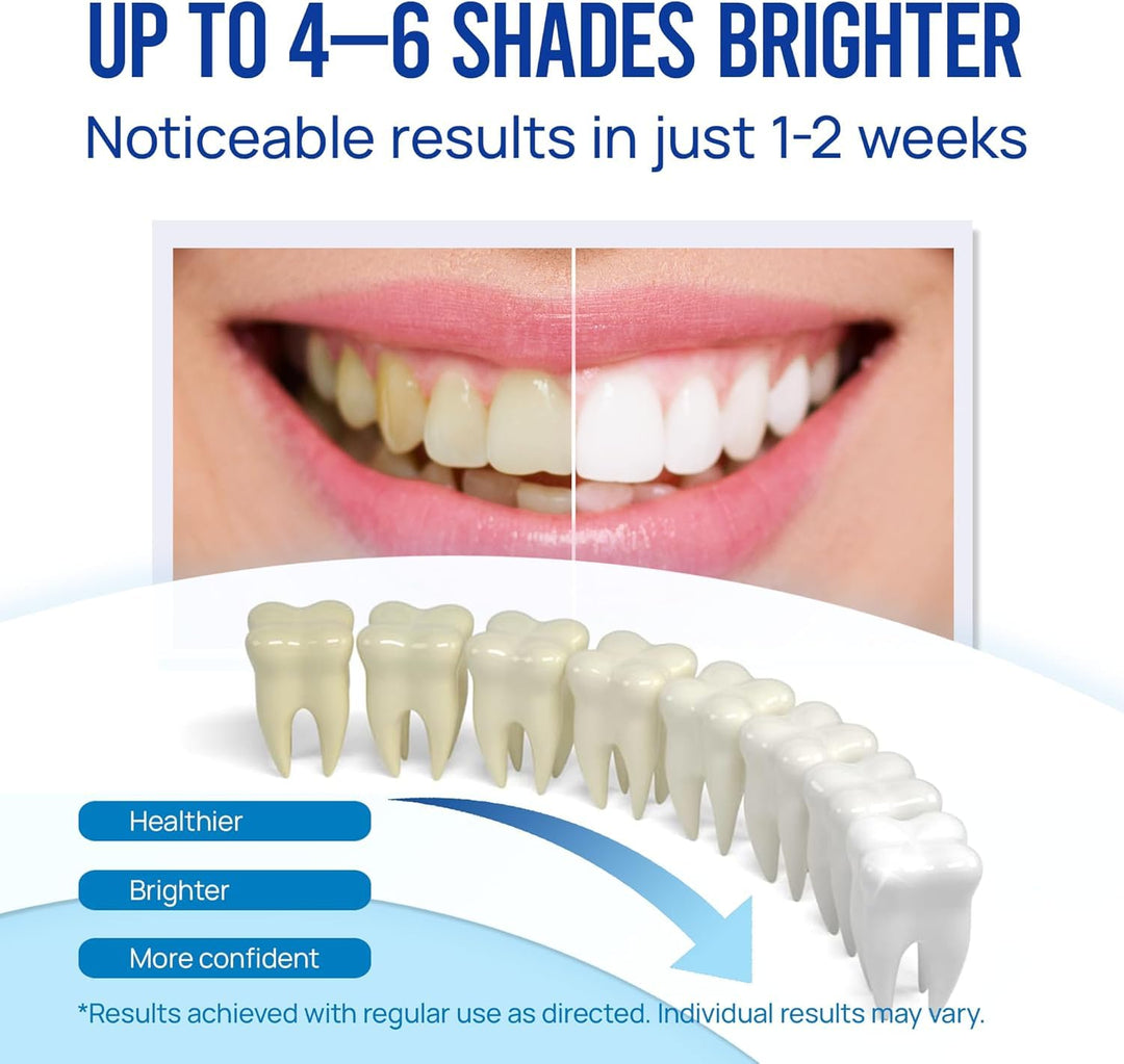 VieBeauti Teeth Whitening Pen, 3 Count