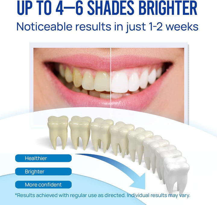 VieBeauti Teeth Whitening Pen, 3 Count