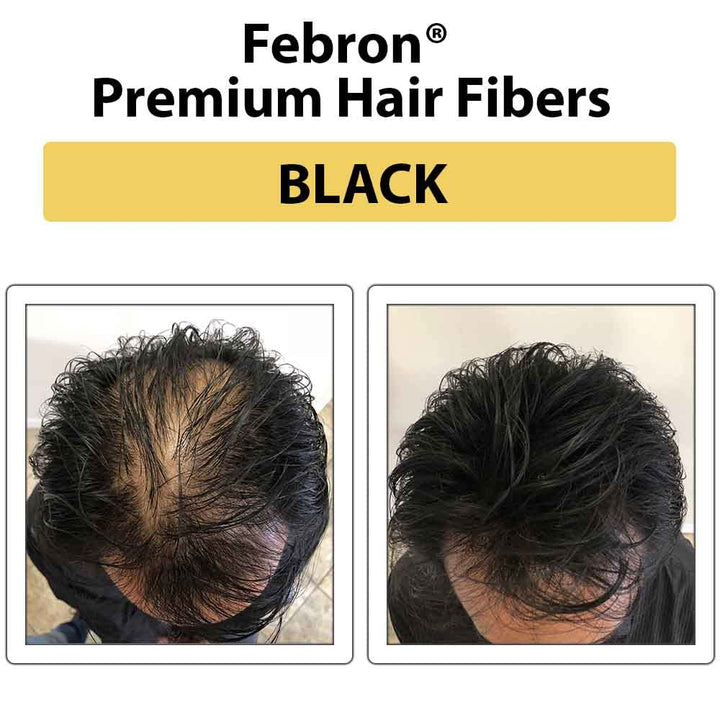 FEBRON Hair Fibers, Black, 30 g