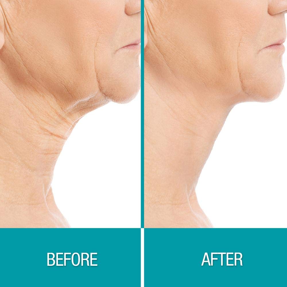 Dermactin Crepe Be Gone Firming Neck Cream