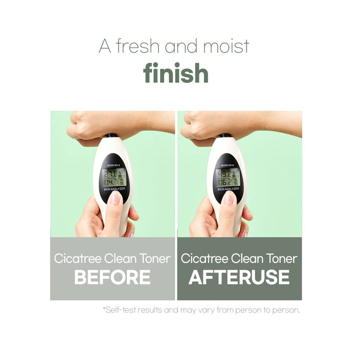 mixsoon Cicatree Clean Toner, 5.07 fl oz