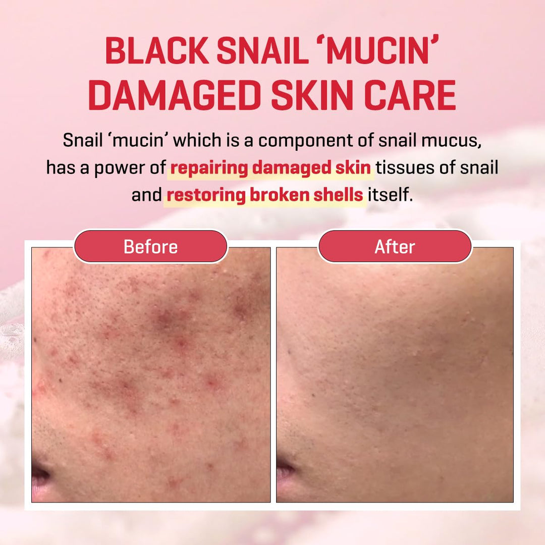 Some By Mi Snail Truecica Miracle Repair Cream, 60 g