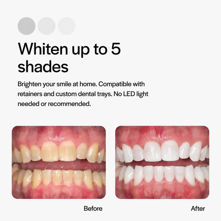 Opalescence PF Teeth Whitening, Mint, 15%, Pack of 4