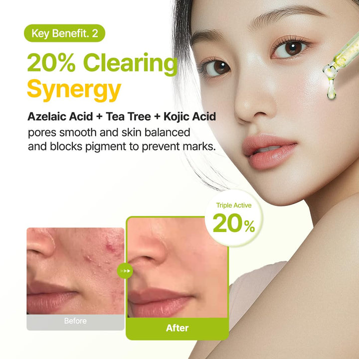 PURITO Azelaic Acid 10 Kojic Serum, 1.01 fl oz