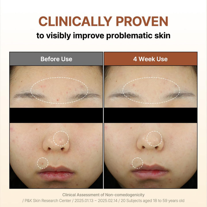 BY WISHTREND Mandelic Acid 5% Skin Prep Water, 1.01 fl oz