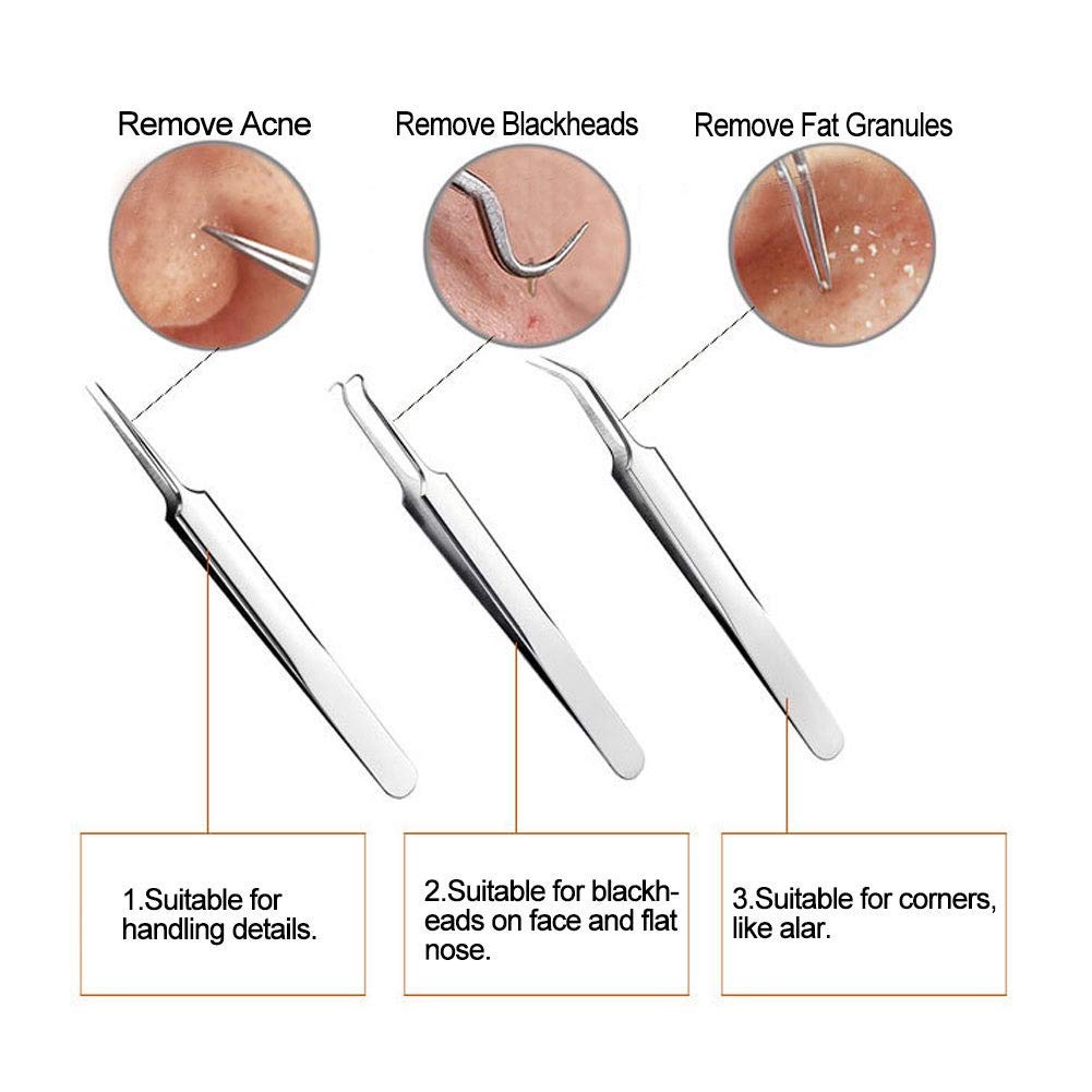 FEITA Blackhead Remover Kit, 5 Count