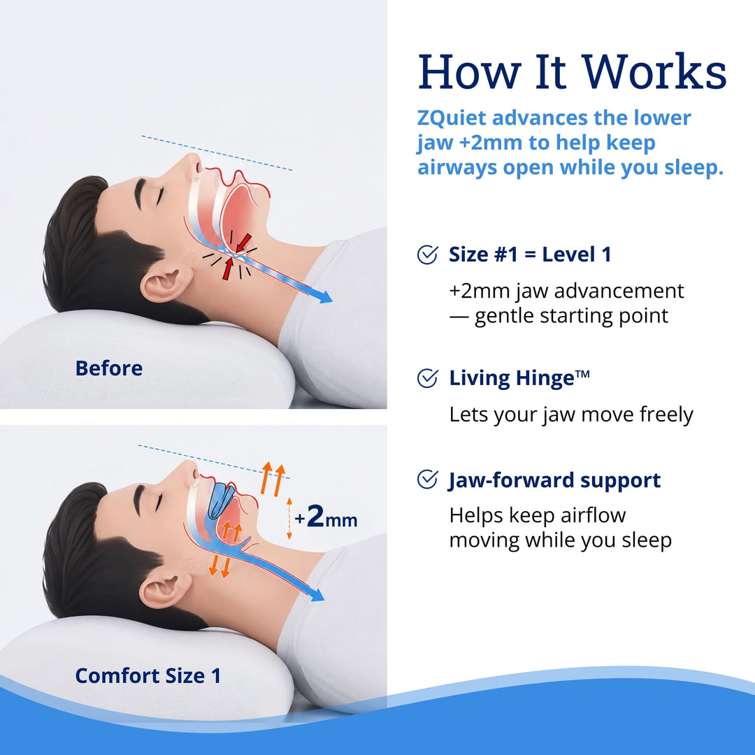ZQuiet Anti-Snoring Mouthpiece, Comfort Size #1, Single Refill