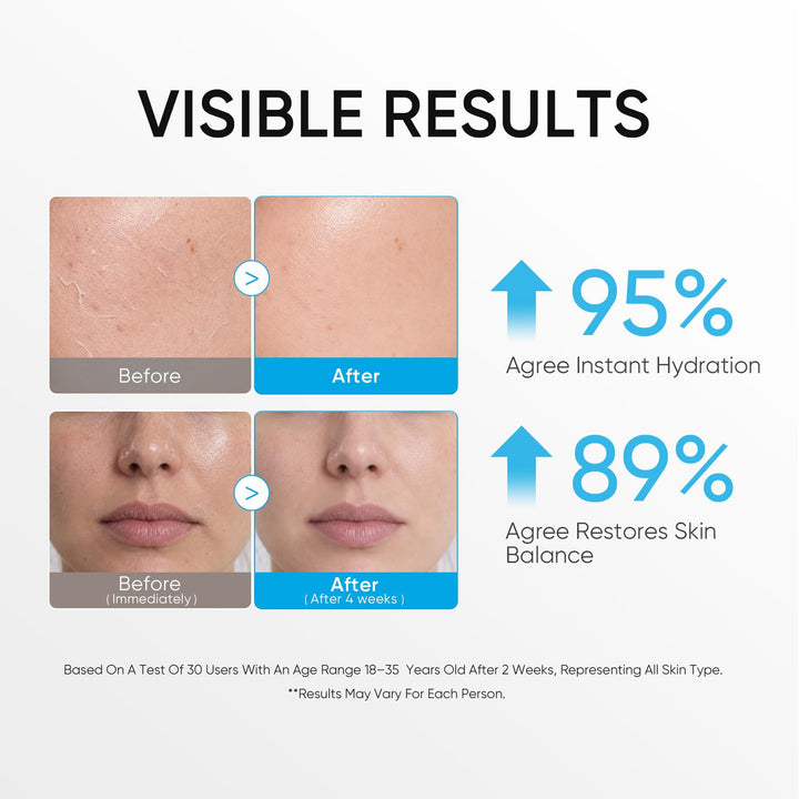 SKINTIFIC 5X Ceramide Barrier Repair Moisturizer