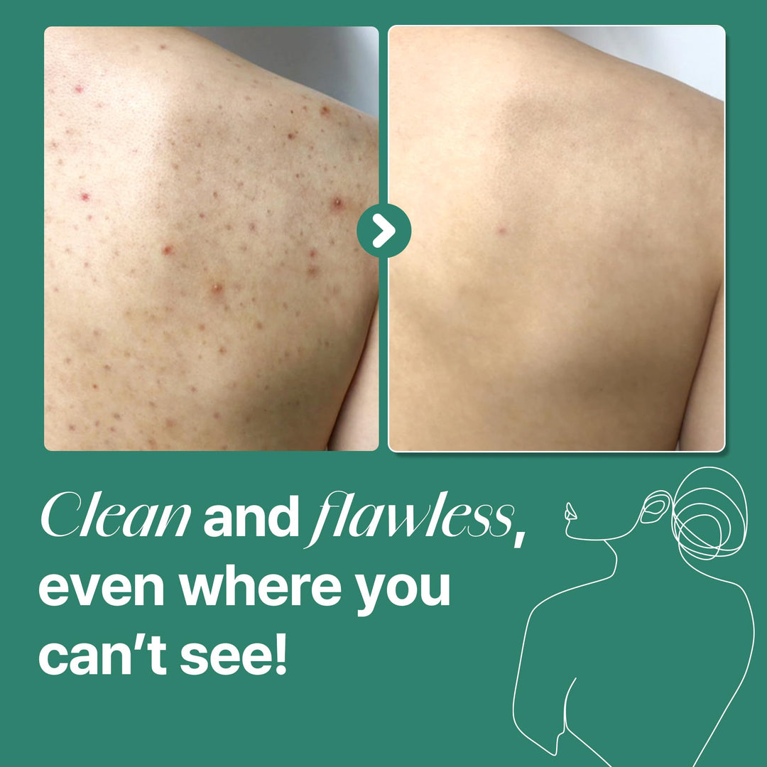 Some by MI AHA BHA PHA 30 Days Miracle Acne Clear Body Cleanser