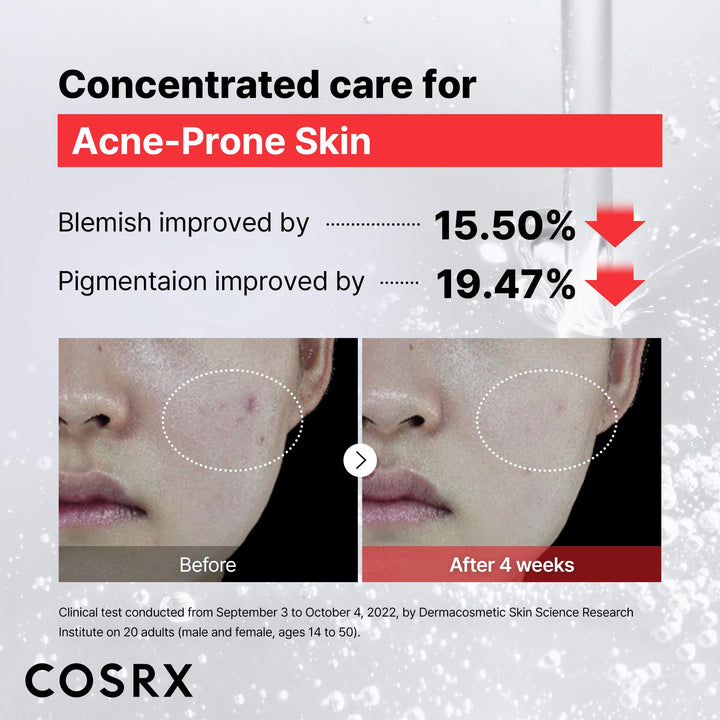 COSRX 15% Niacinamide Face Serum, 0.67 fl oz