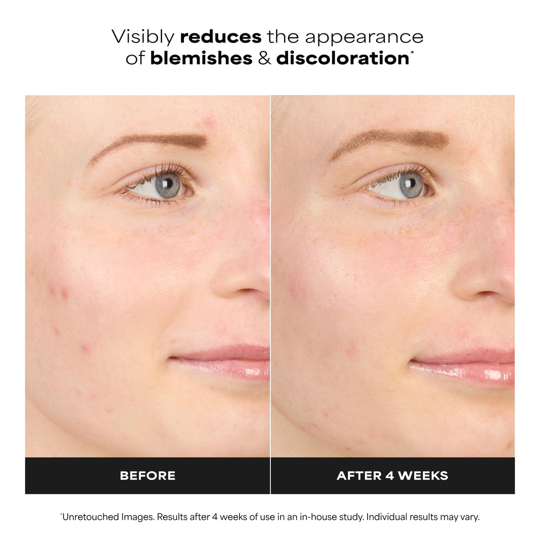 Paula's Choice Boost 10% Azelaic Acid Booster Cream Gel, 1 fl oz