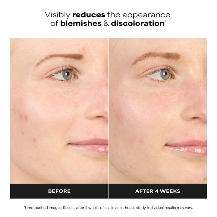 Paula's Choice Boost 10% Azelaic Acid Booster Cream Gel, 1 fl oz