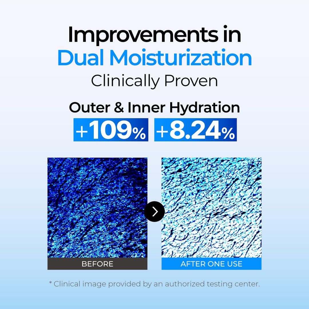 IZEZE Soul HNA Hydro Toner, 5.07 fl oz