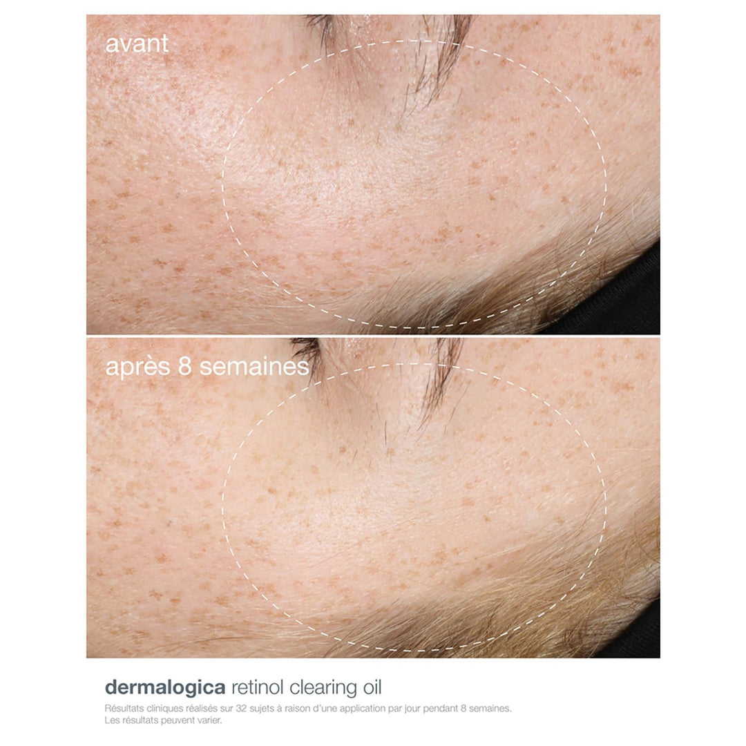 Dermalogica Active Clearing Retinol Oil, 30 ml