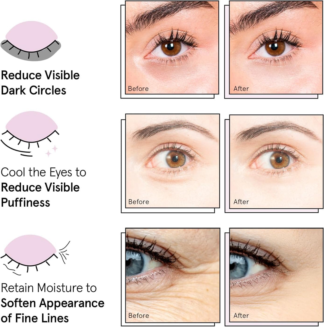 Grace & Stella Under Eye Patches, 12 Count