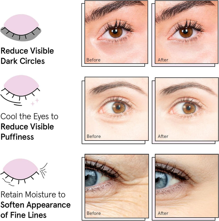 Grace & Stella Under Eye Patches, 12 Count