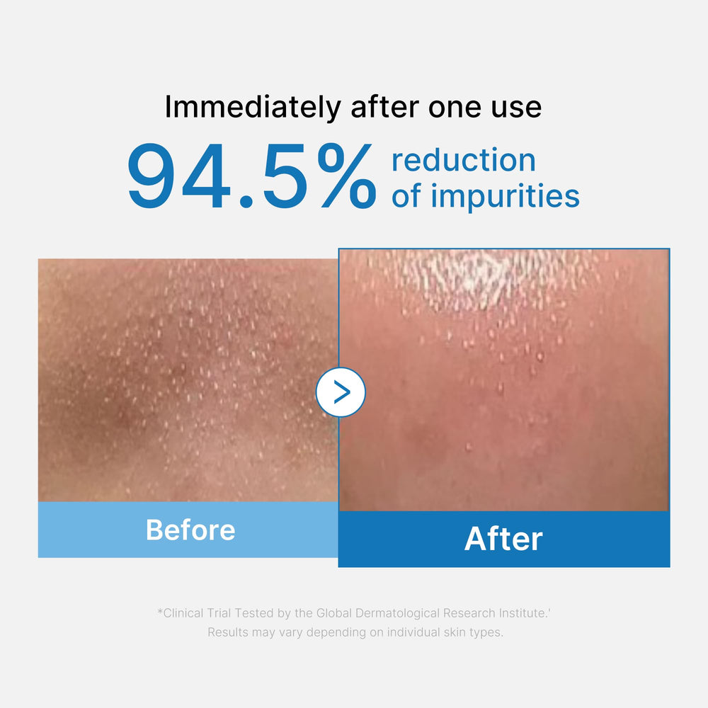medicube Zero Pore Blackhead Cleansing Oil, 205 ml