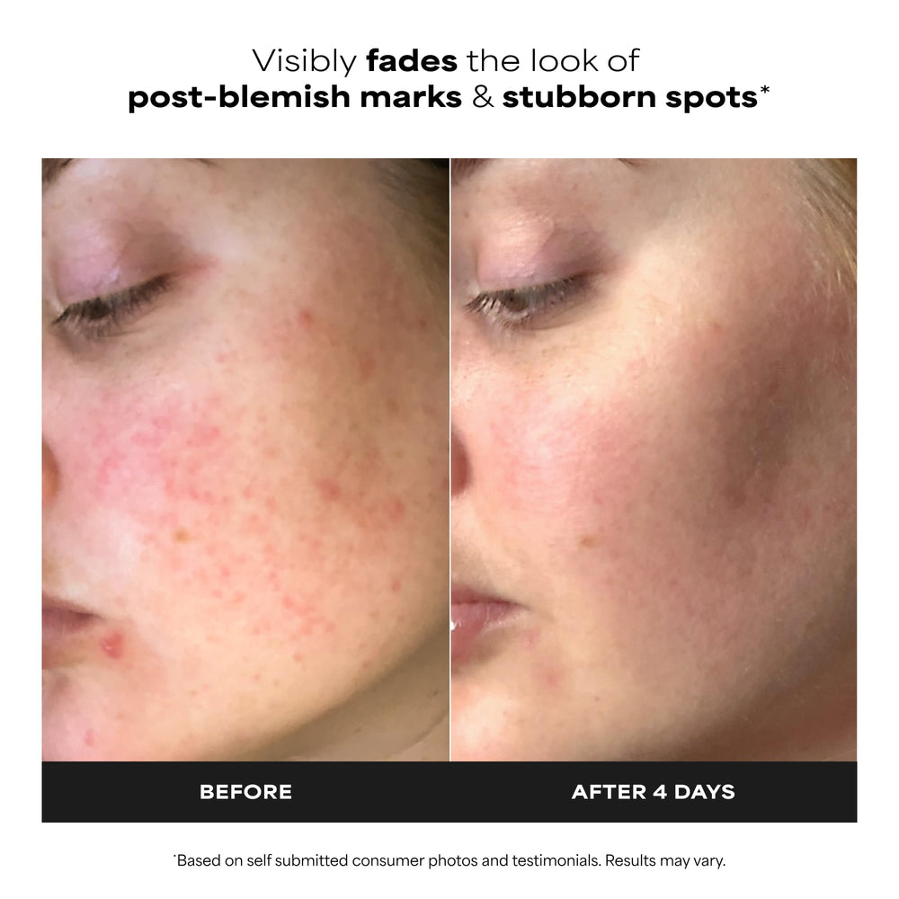 Paula's Choice Boost 10% Azelaic Acid Booster Cream Gel, 1 fl oz