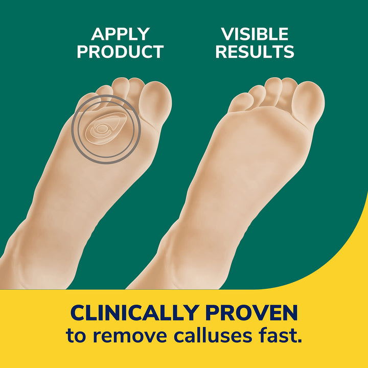 Dr. Scholl's Duragel Callus Remover