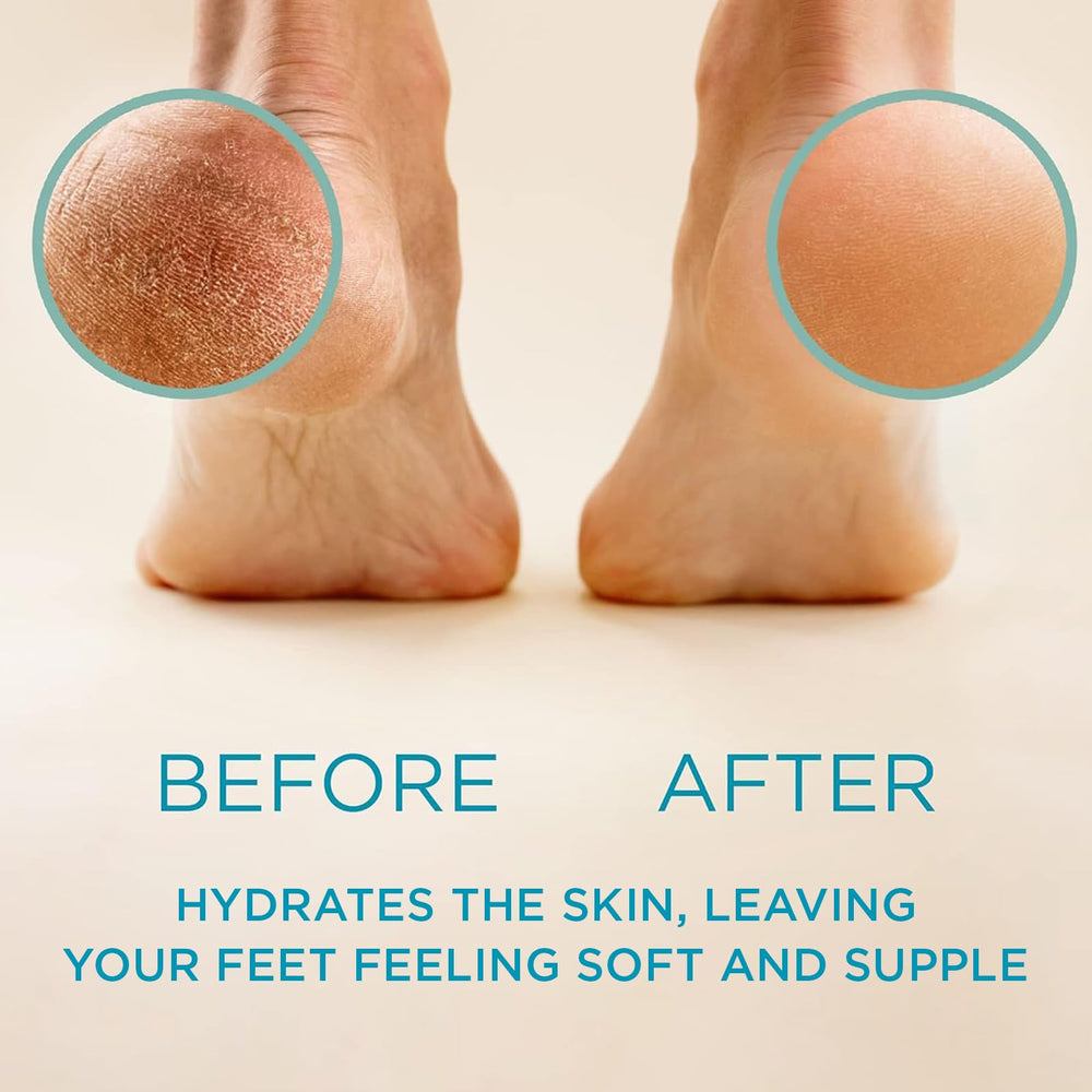 Lee Beauty Professional Callus Remover Gel, Original, 8 oz