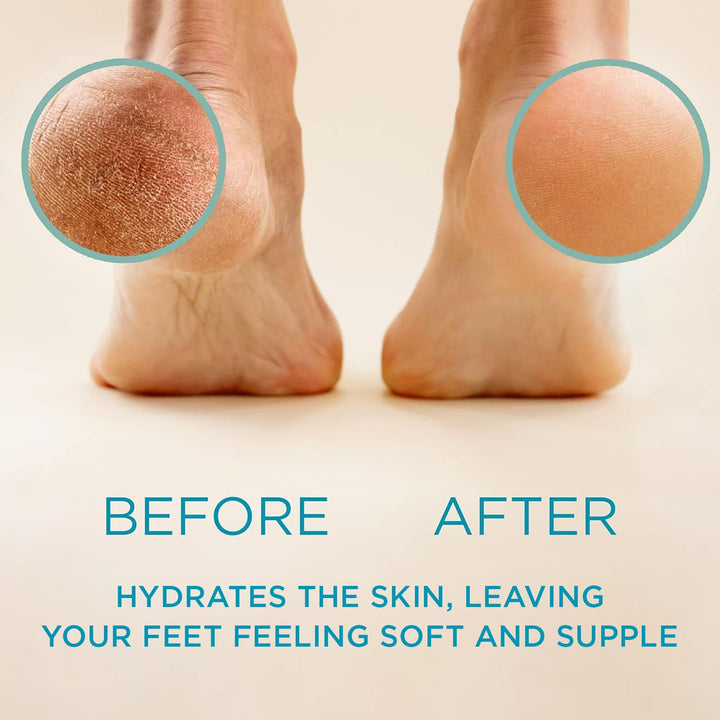 Lee Beauty Professional Callus Remover Gel, Original, 8 oz