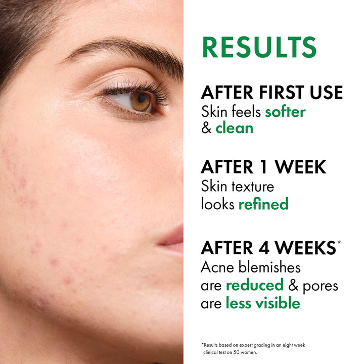 Vichy Normaderm Phytosolution Double-Correction Daily Care, 50 ml