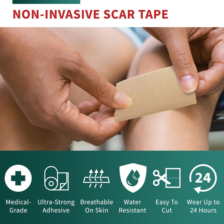 Protect Life Silicone Scar Sheet Roll, 1.6 in x 118 in