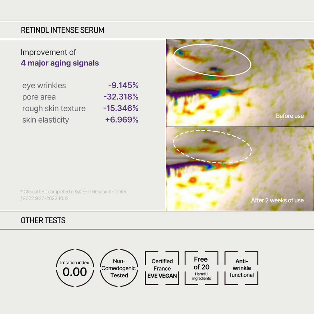 SOME BY MI Retinol Intense Trial Kit, 0.33 oz