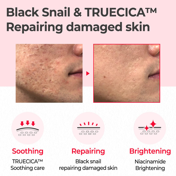 Some By Mi Snail Truecica Miracle Repair Toner, 135 ml