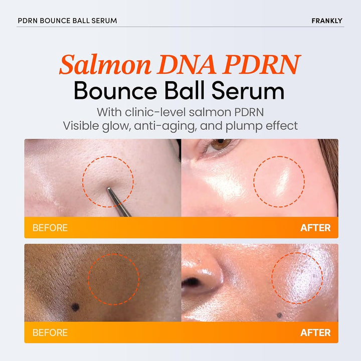 FRANKLY Salmon PDRN Bounce Ball Serum, 1.01 fl oz