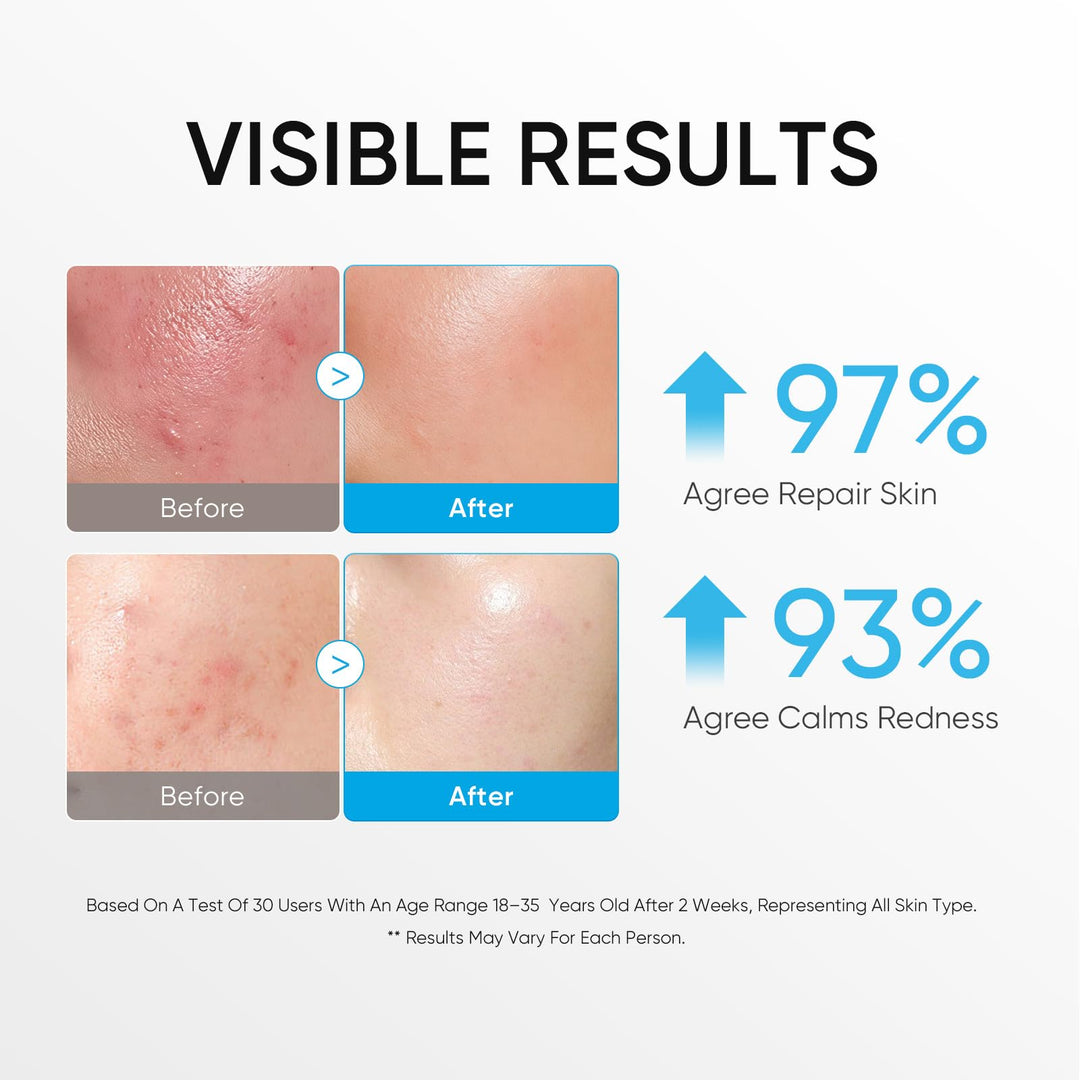 SKINTIFIC 5X Ceramide Barrier Repair Moisturizer