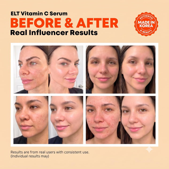 ELT Vita Youth Vitamin C Serum, 1.69 fl oz
