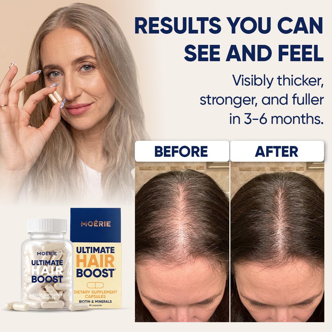 Moerie Hair Growth Supplement, 60 Count
