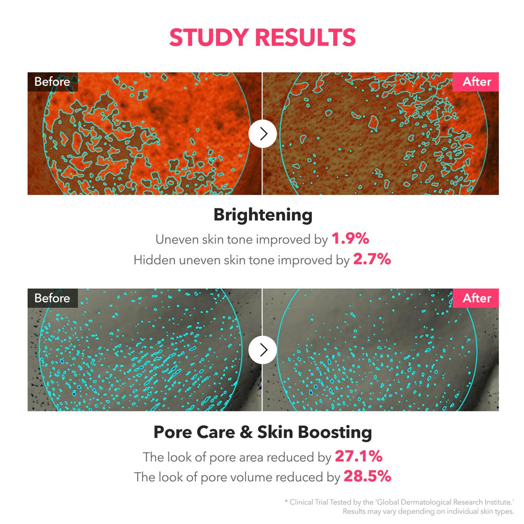 APRILSKIN TXA Niacinamide Toning Shot Serum