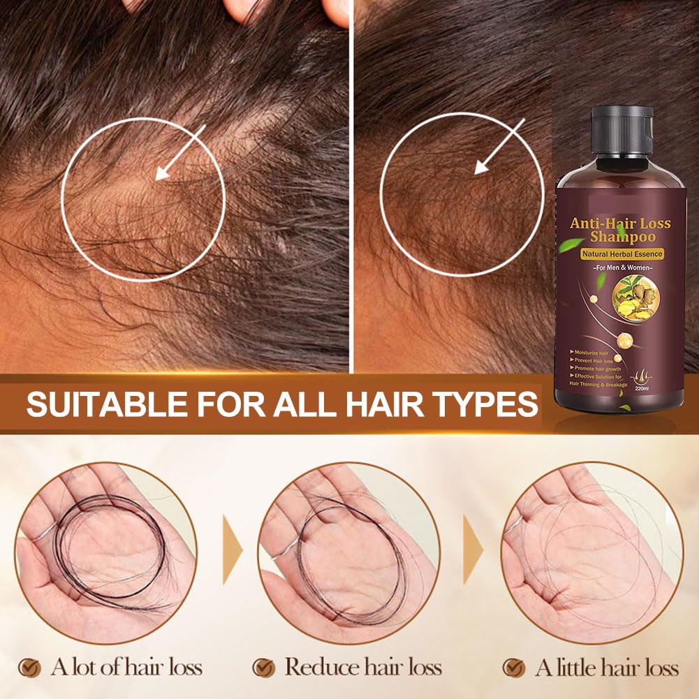 TruuMe Hair Growth Shampoo, 220 ml