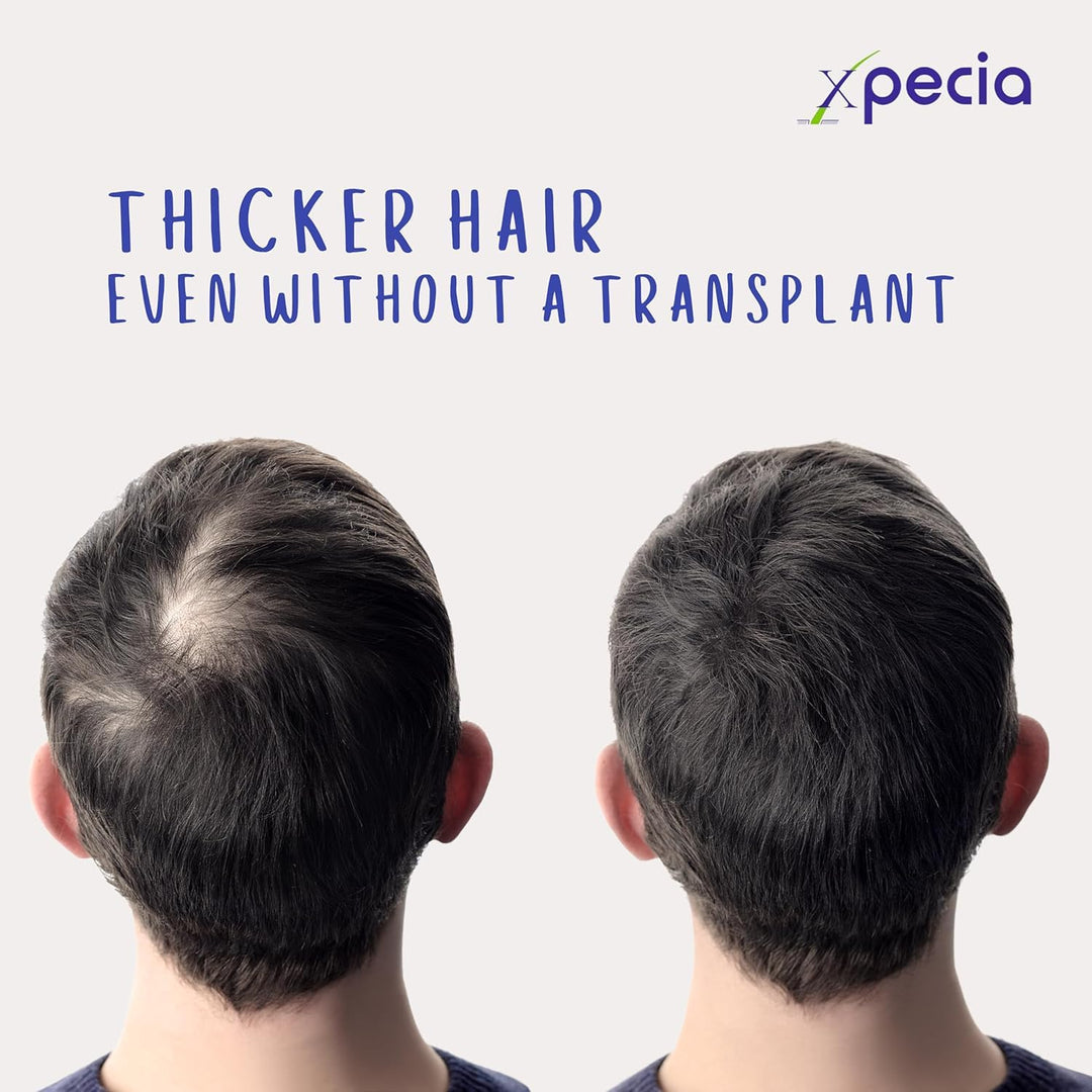 XPECIA Anti Hair Loss DHT Blocker Tablets