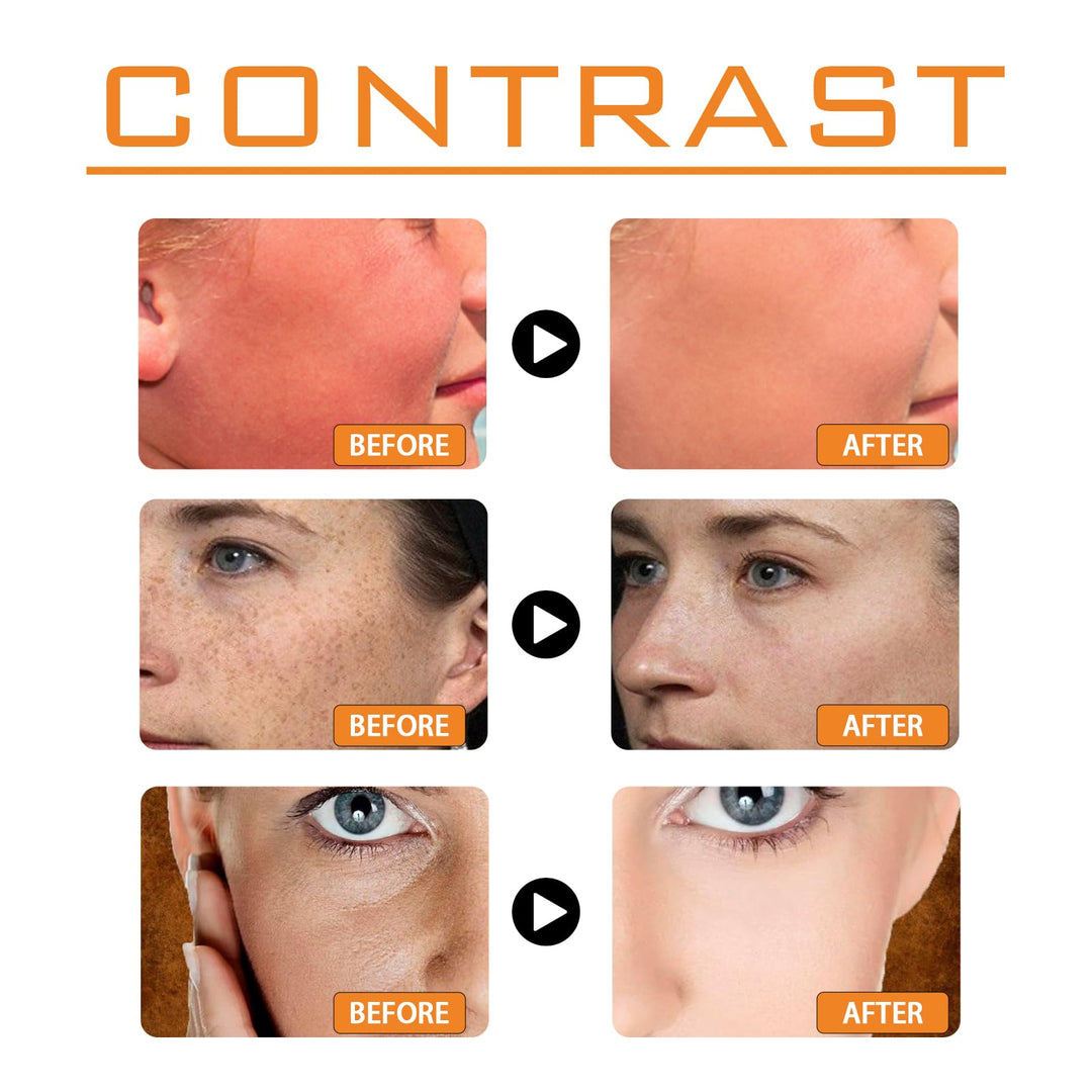 AMALIA Sunscreen, SPF 100