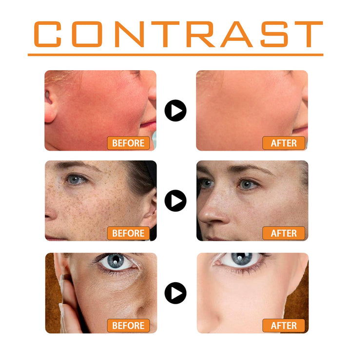 AMALIA Sunscreen, SPF 100