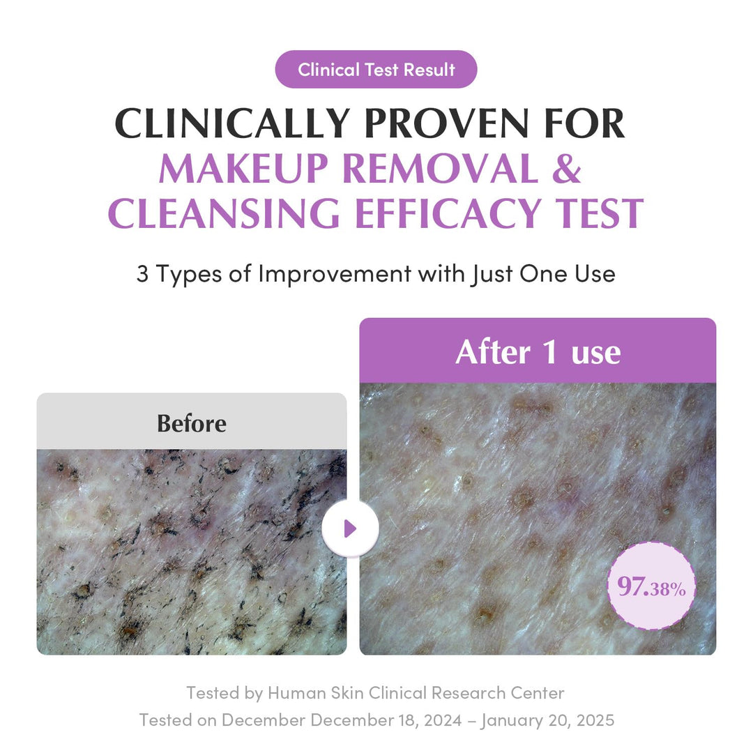 EQQUALBERRY Purple Rice Pore Smoothing Cleansing Oil, 6.76 fl oz